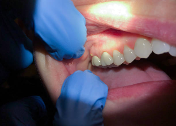Best Orthodontic Emergency Dentist in Lovejoy, GA